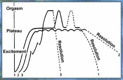 Dr. Jovanovic, OBGYN - Variations in the Female Sexual Response Cycle